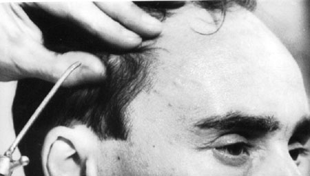 Couverture du film L'Homme au crâne rasé