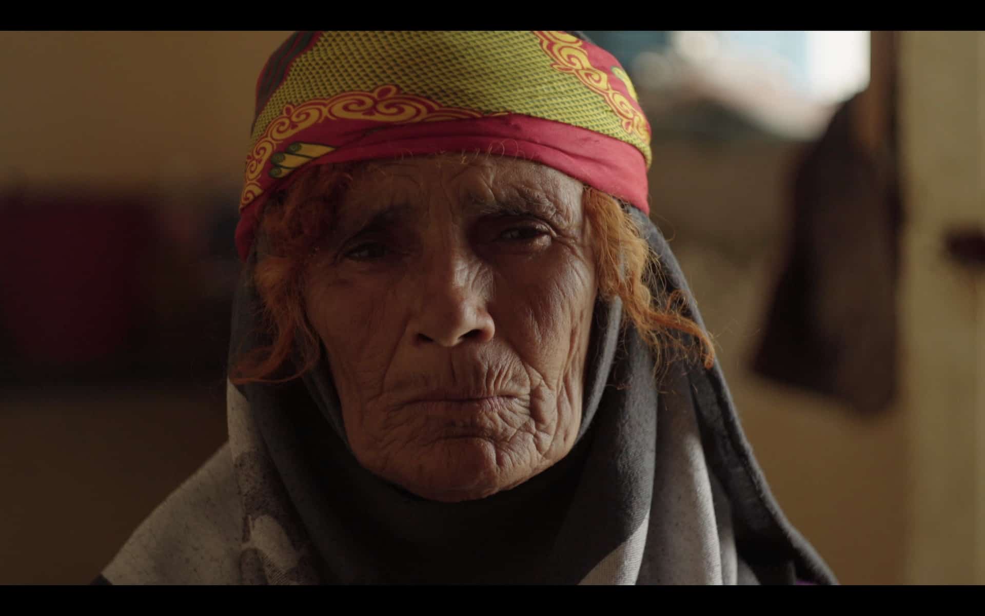 Couverture du film On la nomme brûlure